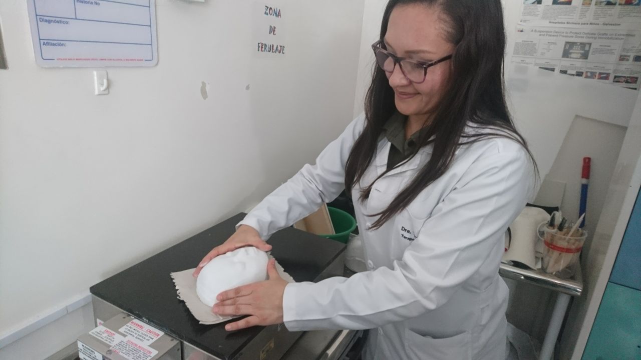 Red pública de Bogotá líder en América Latina en elaboración de máscaras para pacientes quemados