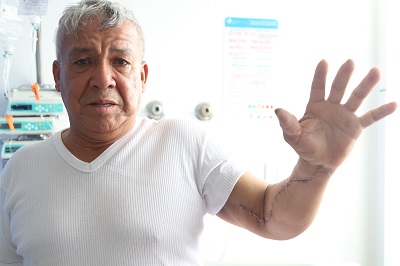 Cirujanos de la Subred Sur le salvan el brazo a hombre con discapacidad